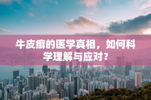 牛皮癣的医学真相，如何科学理解与应对？