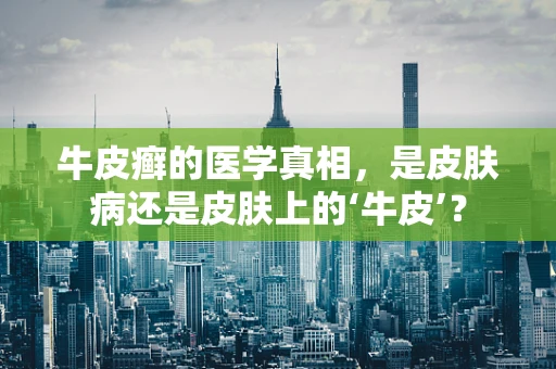 牛皮癣的医学真相，是皮肤病还是皮肤上的‘牛皮’？